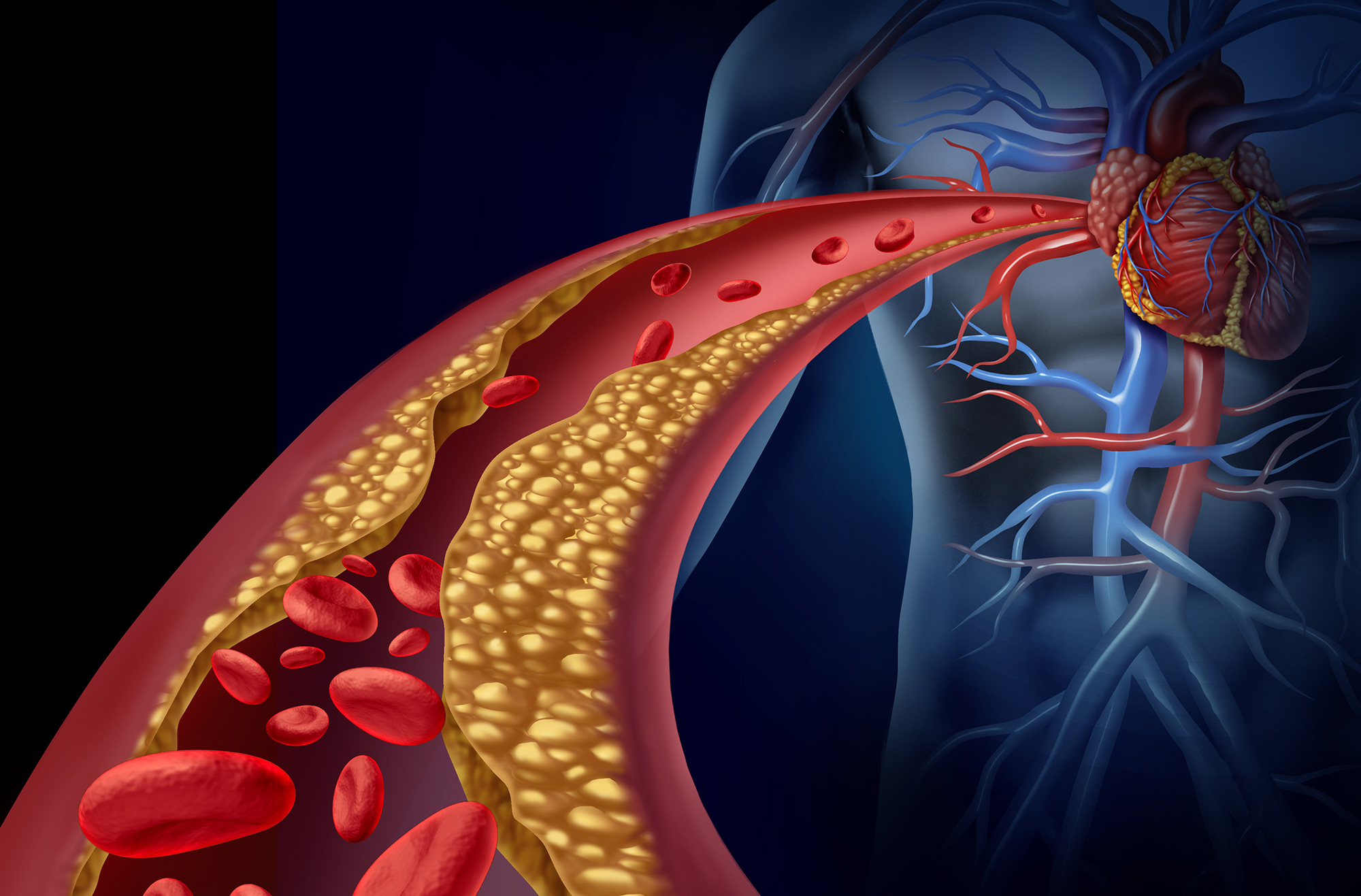 heart-attack-symptoms-and-causes